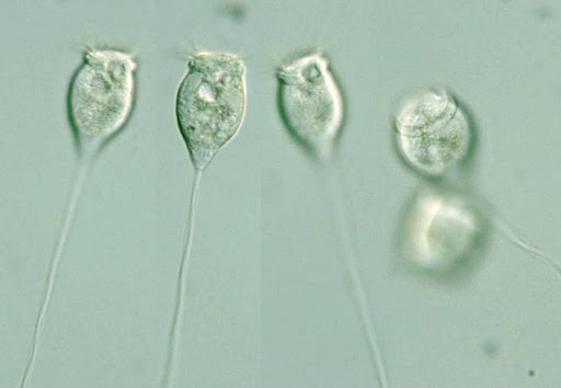Vorticella micostoma