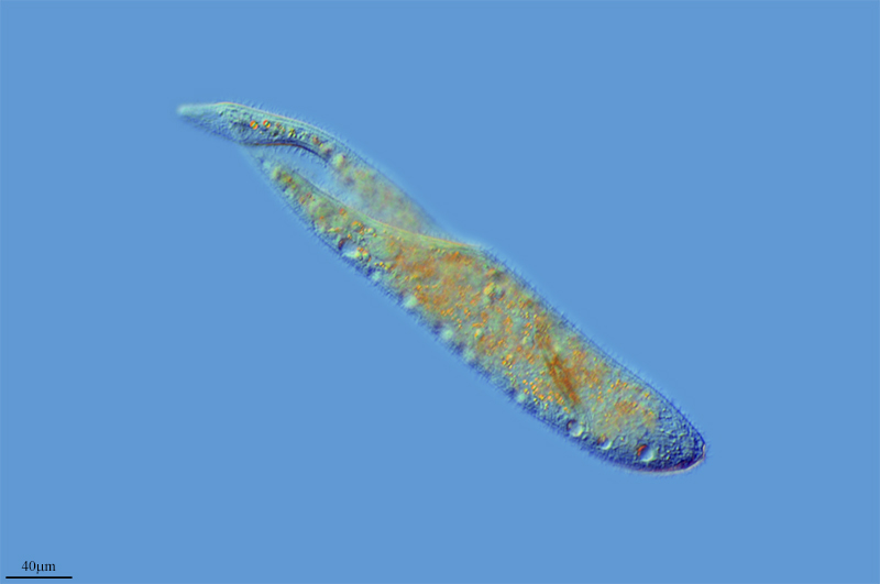Amphileptus